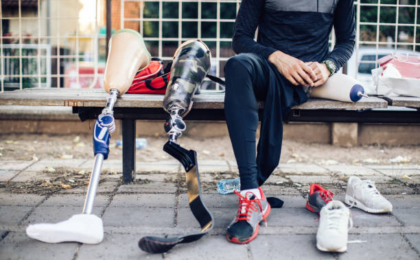 Amputation doesn’t mean the end of an active life. The right prosthetic proves it every day